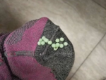 袜子上面有白色液体,卫生隐患与防护措施”